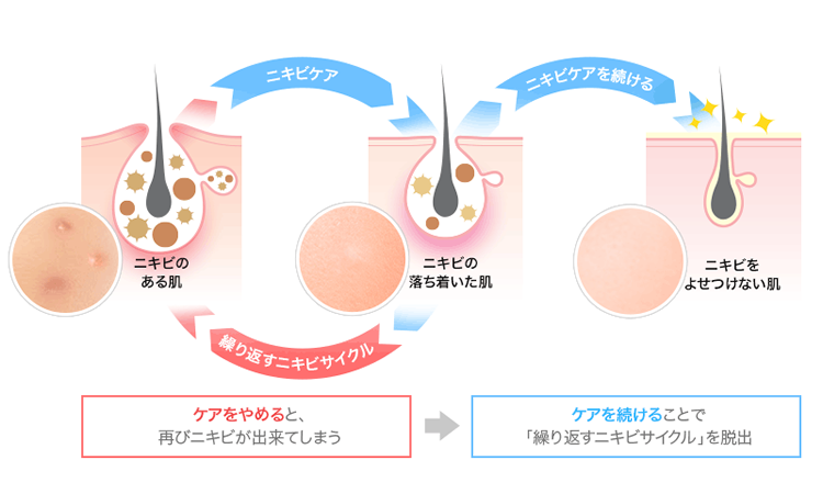 継続的なケアの必要性