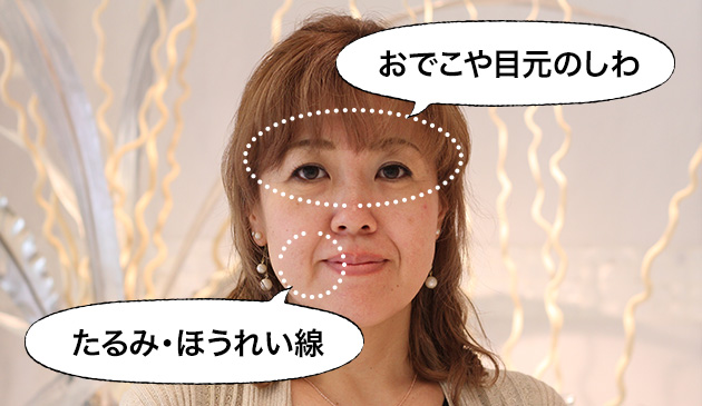 松谷様の肌のお悩み