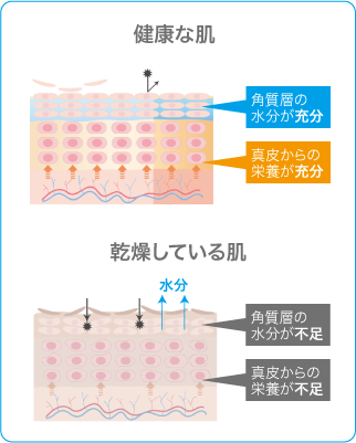 肌図