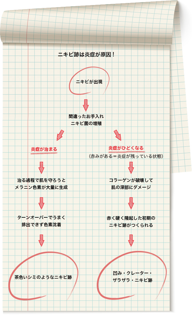 美子の秘蔵ノート〈ニキビ跡の原因とメカニズム〉