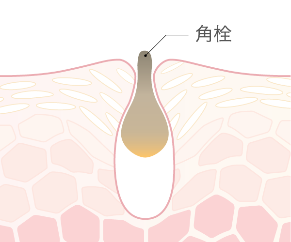 毛穴とターンオーバーの関係