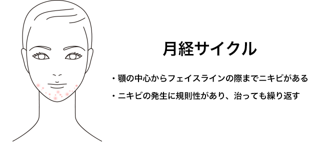 本当の原因はコレ！繰り返す大人の顎ニキビを治す方法