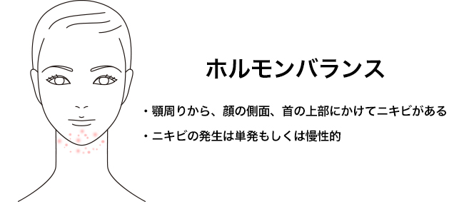 本当の原因はコレ！繰り返す大人の顎ニキビを治す方法