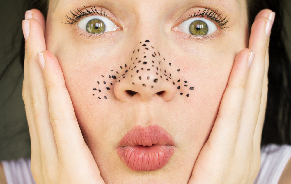 鼻の黒ずみをスッキリ除去する３つの方法