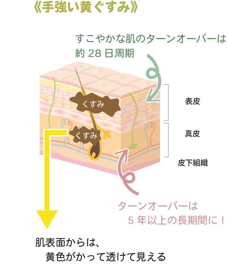 「黄ぐすみ」とはなに？「たるみ」にもつながる真実と解決法！