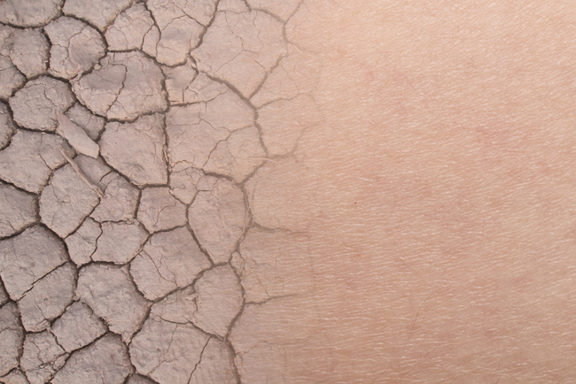 乾燥肌の正しいスキンケア方法で、この冬は「しっとり肌」を実現！