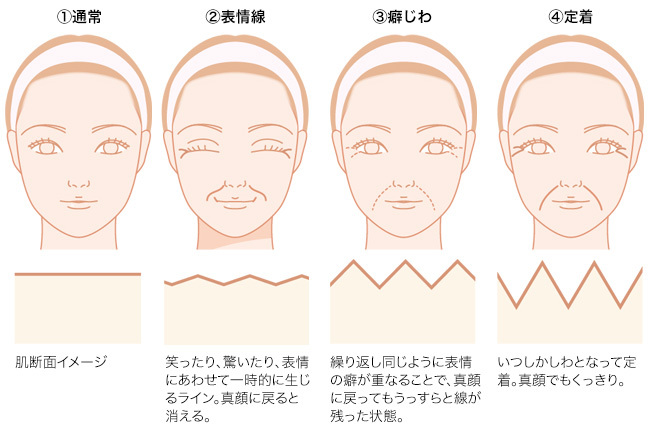 しわの原因は老化だけじゃない!? 種類別の正しい対策法