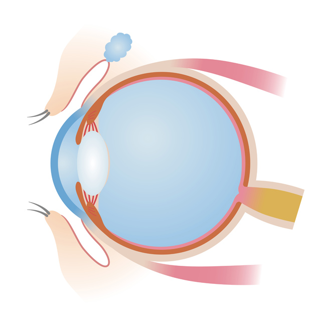 瞳を守る「目の紫外線対策」〜正しい眼球ケア＆眼病予防編
