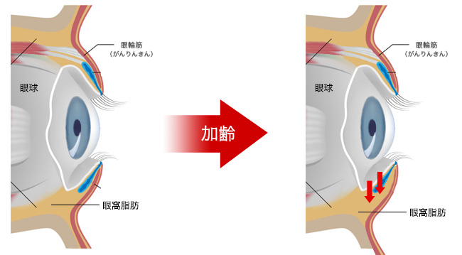 気になる「マスク老け」対策Vol.1マスクで目立つ「目元」たるみ・くぼみ編