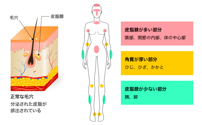 ガサついたひじ、ひざ、かかとで、春夏を迎えても大丈夫？