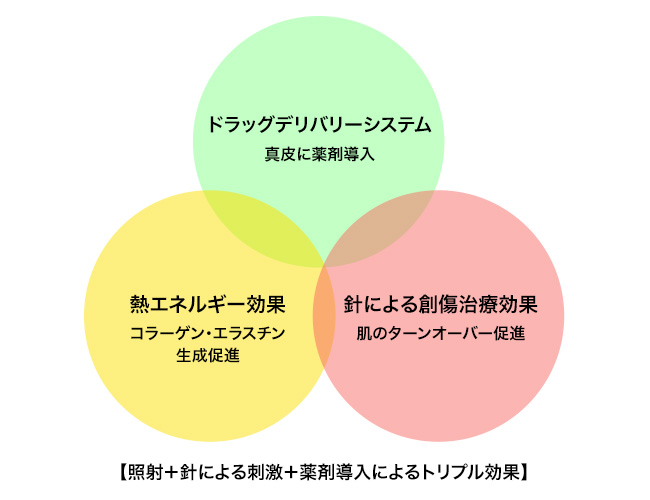 美容クリニックの施術や治療って？おすすめ施術【悩み別】徹底解説！③【ニキビ・毛穴】ポテンツァ（POTENZA）