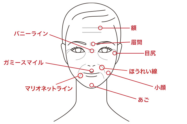 美容クリニックの施術や治療って？おすすめ施術【悩み別】徹底解説！⑧【しわ・小顔】ボトックス