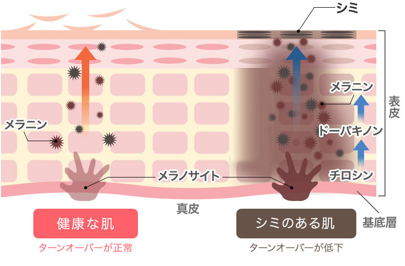 美容医療界で大注目の美容成分「グルタチオン」って何がすごいの？①【美白と深い関係だった！】― 知って損なし！美容の知識　―