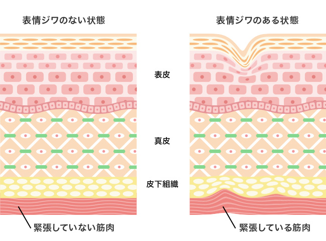 「塗るボトックス」知っておきたい「アルジルリン」の基礎知識